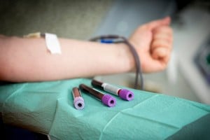 1505332544493-jpg-roma__l_allarme_per_il_virus_chikungunya_aumenta__stop_alle_donazioni_di_sangue_per_1_2_miloni_di_cittadini_