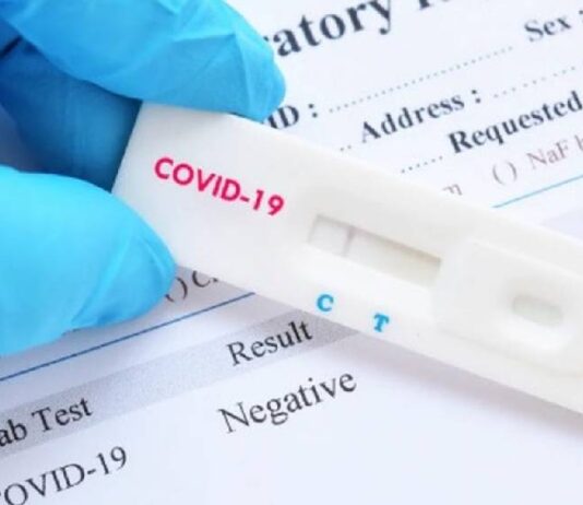 Coronavirus, 5600 test rapidi gratis in arrivo a Nettuno